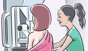 Ψηφιακή Μαστογραφία – Τομοσύνθεση